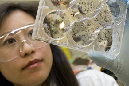 Closeup of a researcher looking at agar plates