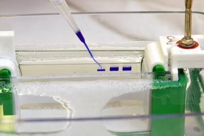 Lab equipment used in ovarian cancer research