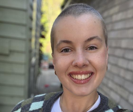 A photo of Claire with her hair shaved