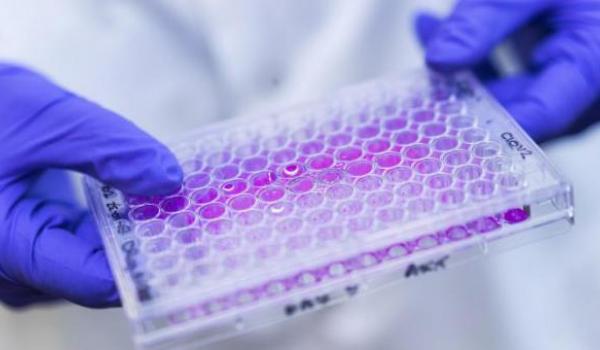 A closeup of a researcher wearing gloves while holding lab equipment