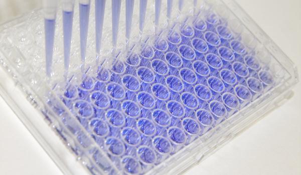 Pipettes in a lab being used for ovarian cancer research