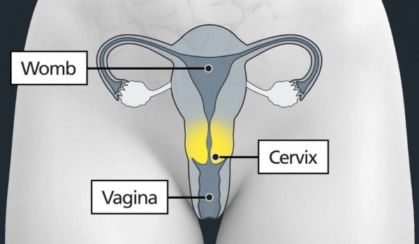 A diagram of the female reproductive system labelling the womb, cervix and vagina