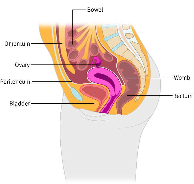 peritoneal cancer types