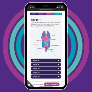 A mobile phone screen showing the new stages tool explaining ovarian cancer stages and grades