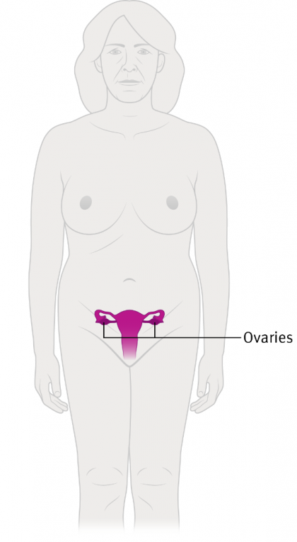 Diagram showing the location of the ovaries in the body