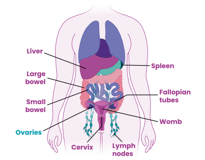 Diagram to show lower organs removed during surgery for ovarian cancer