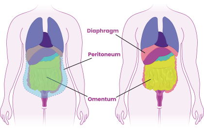 Diagram to show upper organs that may be removed during surgery for ovarian cancer