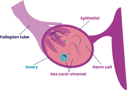 A close-up illustration showing the epithelial, germ cell and sex cord stromal within the ovary.