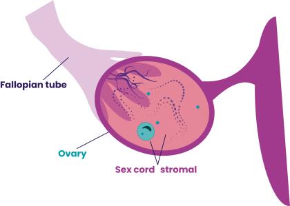 A close-up illustration showing sex cord stromal cells within the ovary.